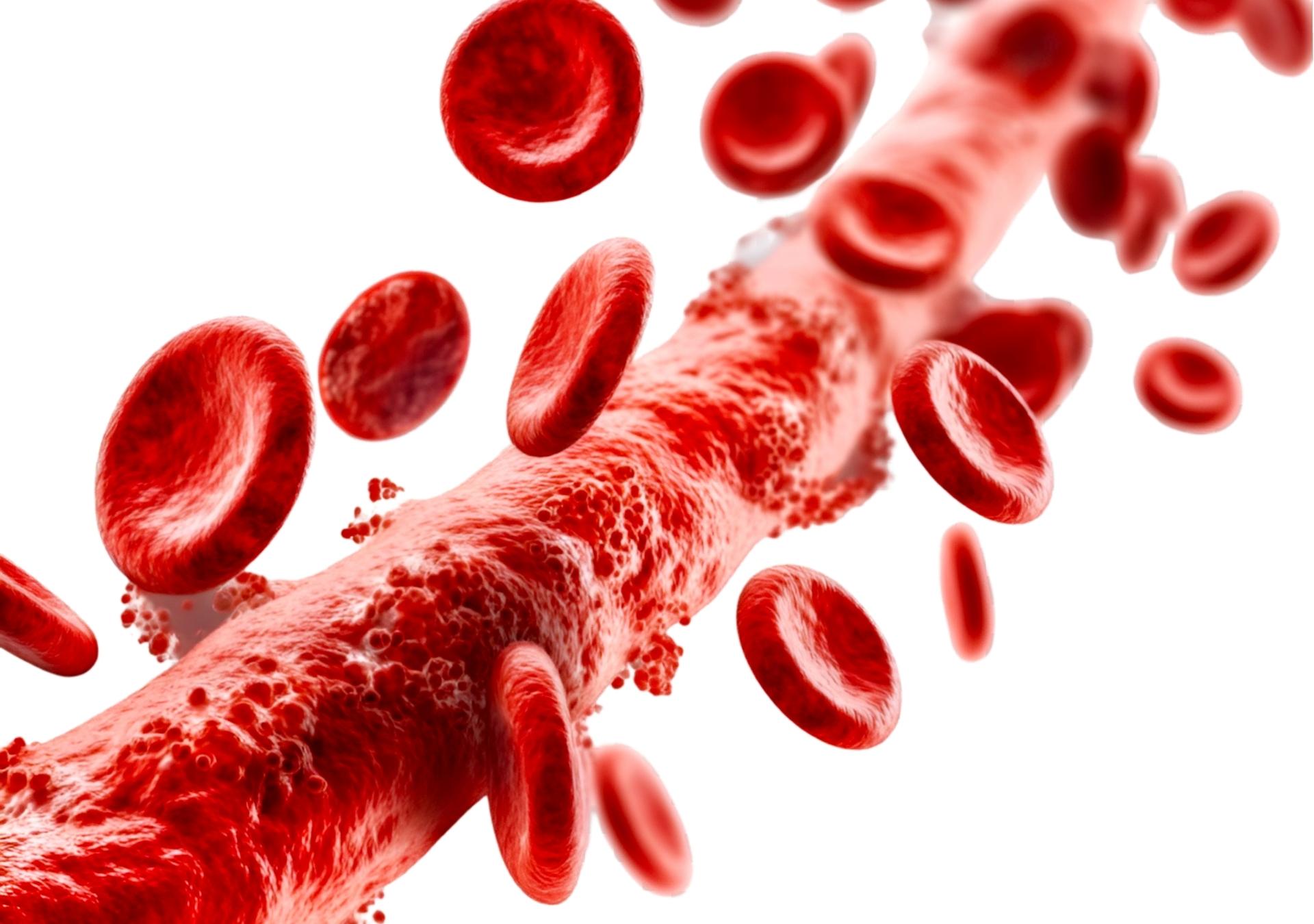 Exame de sangue inovador promete revolucionar o diagnóstico precoce de câncer de pâncreas